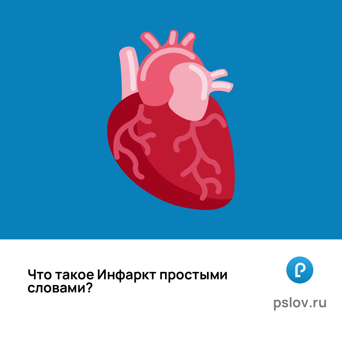 Что такое Инфаркт простыми словами - визуальное объяснение