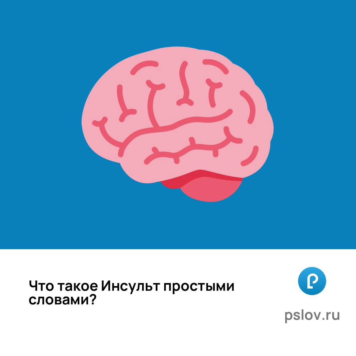 Что такое Инсульт простыми словами - визуальное объяснение