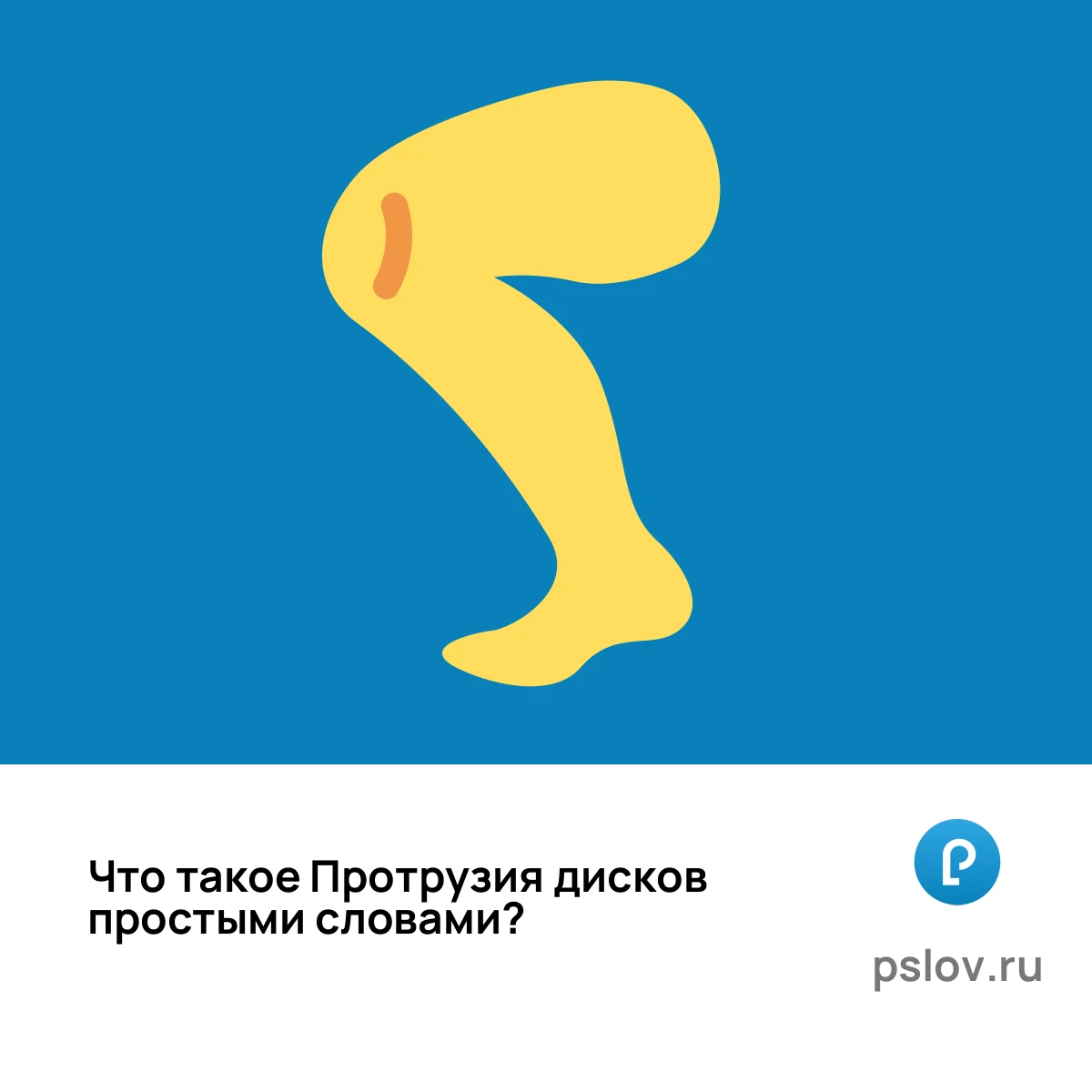Что такое Протрузия дисков простыми словами - визуальное объяснение